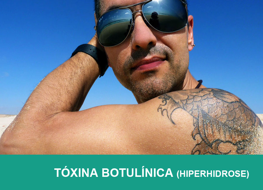Tóxina botulínica (hiperhidrose)