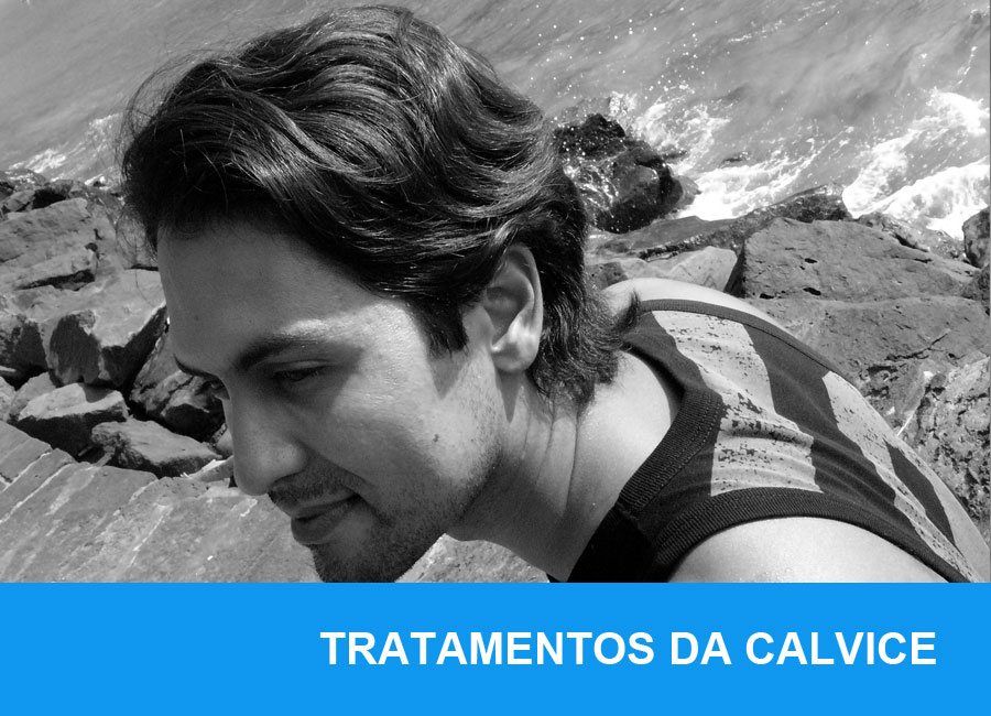 Tratamento da Calvície